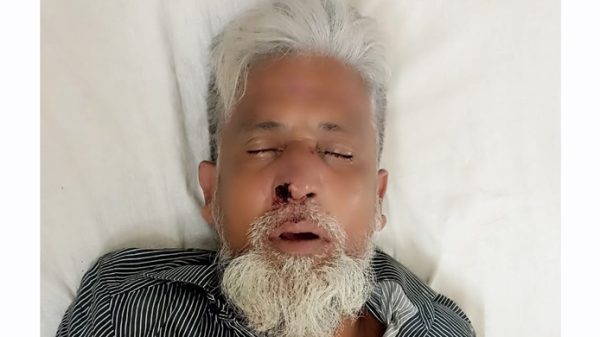 বিষ্ণুদীতে জমি মাপার বৈঠকে বিএনপি নেতাকে পিটিয়ে জখমের অভিযোগ